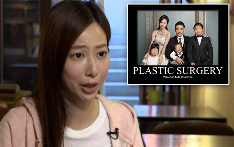 Fakta Foto Keluarga Operasi Plastik di Cina