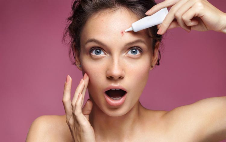 Acne Spot Gel Terbaik